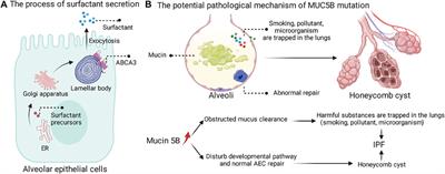 Research Progress in the Molecular Mechanisms, Therapeutic Targets, and Drug Development of Idiopathic Pulmonary Fibrosis